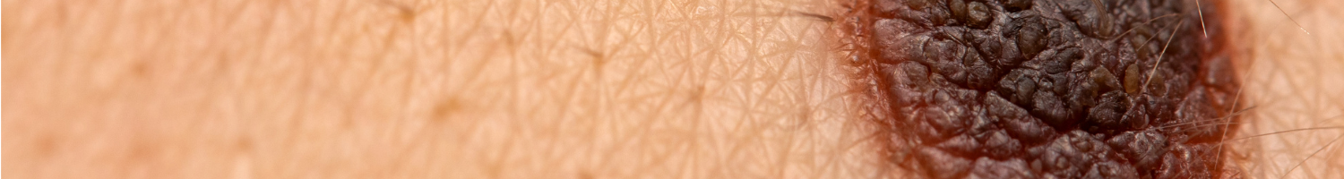 2025 EDW Multidisciplinary General/GI/Melanoma Tumor Board (RSS) Banner